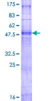 Human PIGC Protein (Recombinant GST)