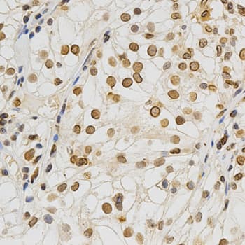 LMNA / Lamin A+C Antibody