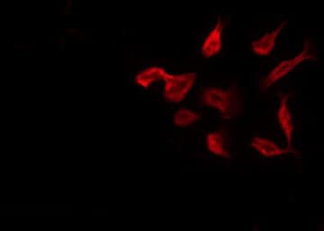 TUSC3 Antibody