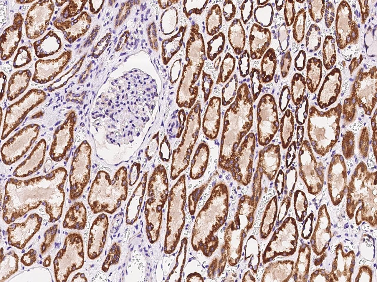 Polyclonal Rabbit anti-Human TLR3 Antibody (Preservative Free, IHC, IF)
