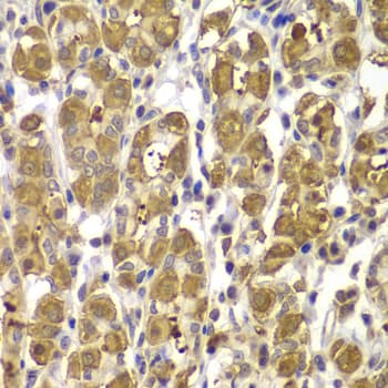 FAK / Focal Adhesion Kinase Antibody