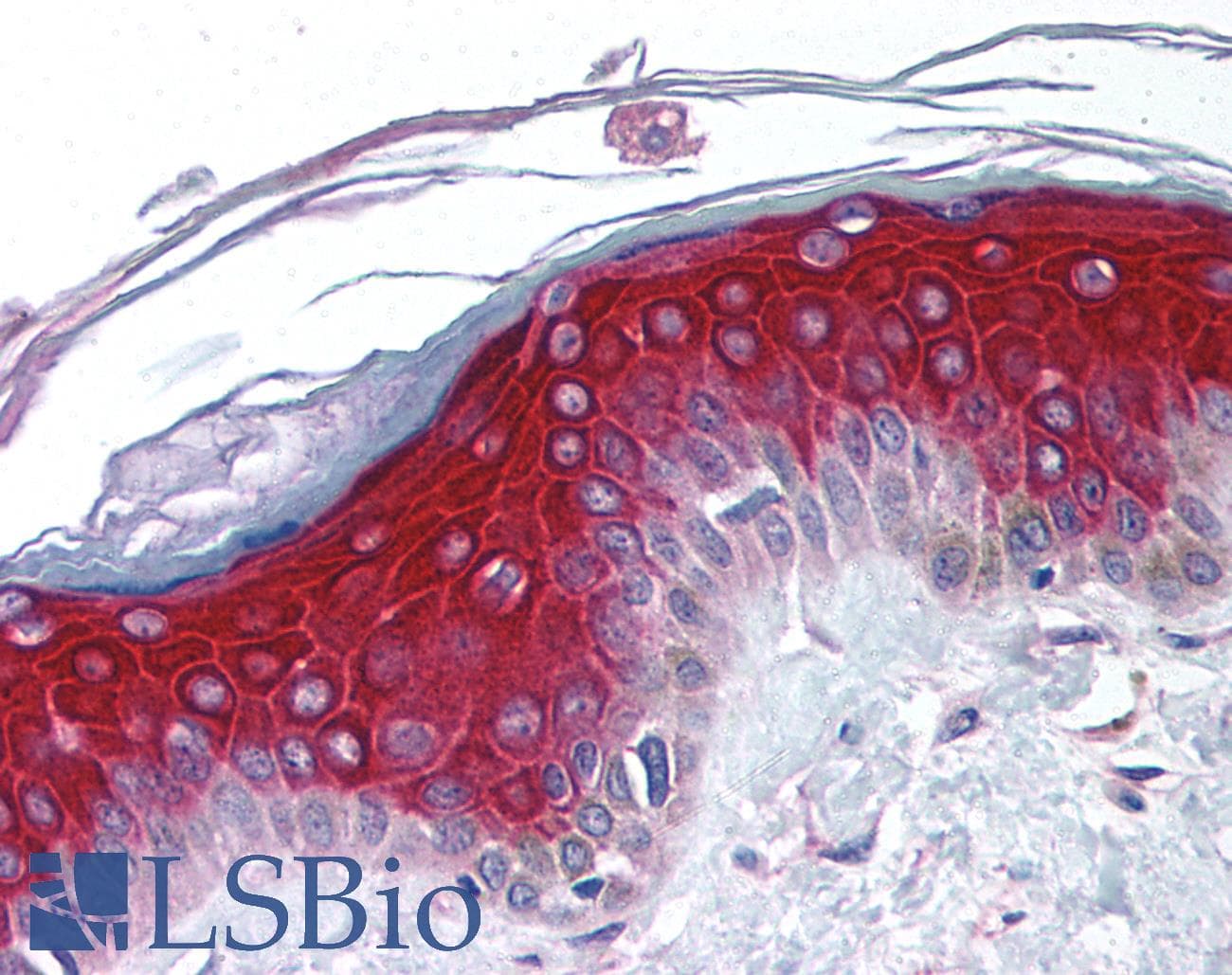 IHC-plus™ Polyclonal Rabbit anti-Human RPS6KA1 / RSK1 Antibody (IHC, IF, WB)