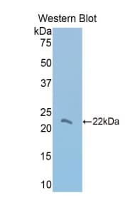 THBS1 / Thrombospondin-1 Antibody (aa957-1129)