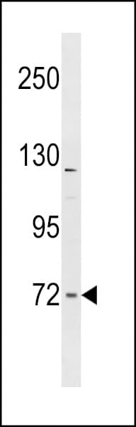 TOCA1 / FNBP1L Antibody (aa349-377)