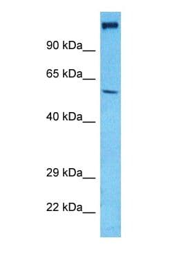 SLC17A7 / VGLUT1 Antibody (N-Terminus)