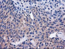 SULT1C2 / Sulfotransferase 1C2 Antibody (clone OTI4G1)