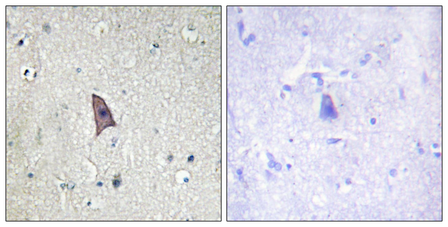 Polyclonal Rabbit anti-Human TEK / TIE2 Antibody (phospho-Tyr1102, IHC)
