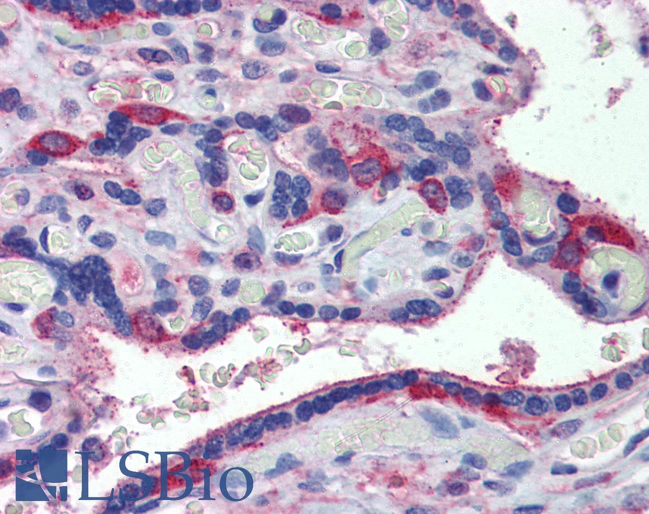 IHC-plus™ MARCH8 Antibody