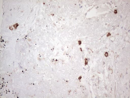 c-Kit / CD117 Antibody (aa27-308, clone OTI1B6, Carrier-free)