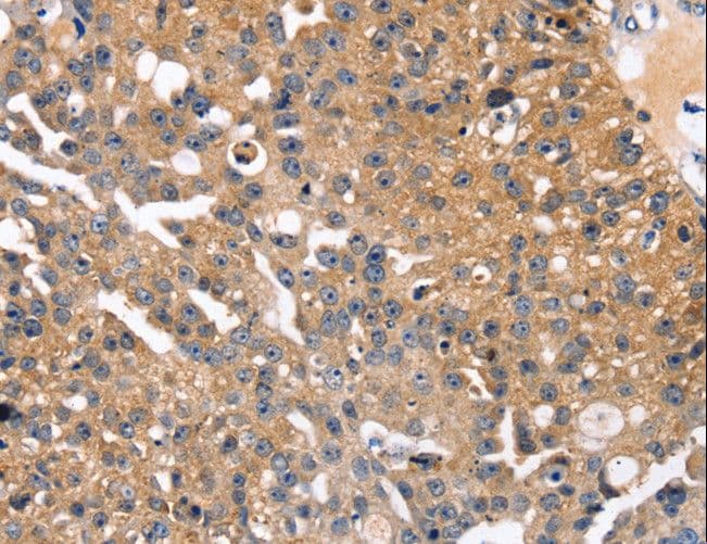 SLC2A2 / GLUT2 Antibody