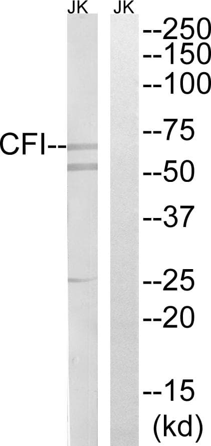 CFI / Complement Factor I Antibody