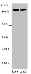 PDE6A / PDE6 Alpha Antibody