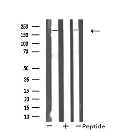 CDC42BPA / MRCK Antibody