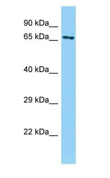 ABLIM1 Antibody (aa121-170)