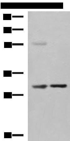 KHK / Ketohexokinase Antibody
