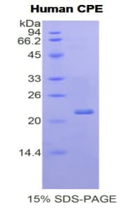 Human CPE / Carboxypeptidase E Protein (Recombinant His)