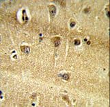 RPS9 / Ribosomal Protein S9 Antibody (aa135-164)