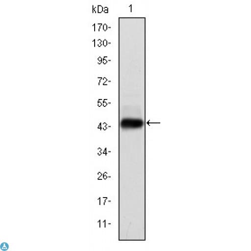 Monoclonal Mouse anti-Human HPV11 E7 Antibody (IHC, WB)