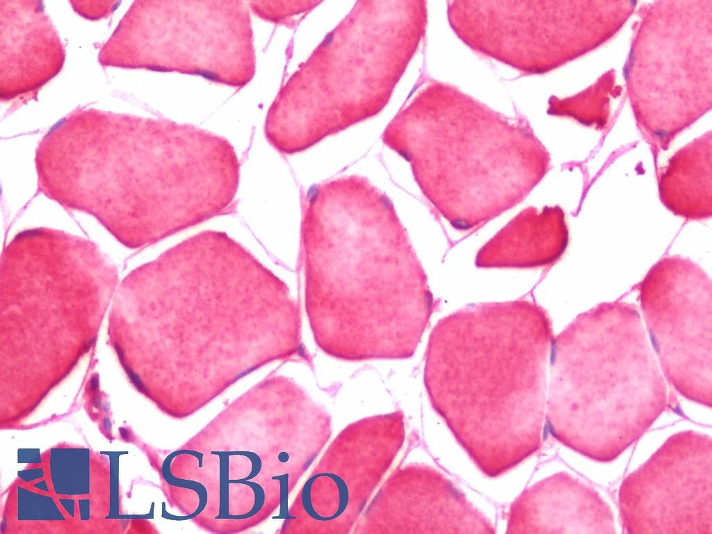 IHC-plus™ CRLF1 Antibody (aa130-415)