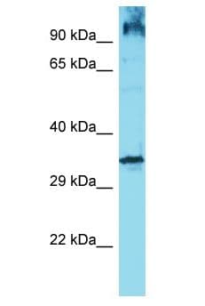 Polyclonal Rabbit anti-Human OR6Q1 Antibody (aa261-310, WB)