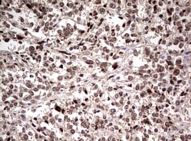 Monoclonal Mouse anti-Human NUMB Antibody (clone OTI2F1, aa1-365, IHC, WB)