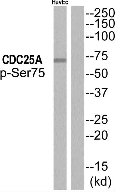 Polyclonal Rabbit anti-Human CDC25A Antibody (phospho-Ser75, IHC, WB)
