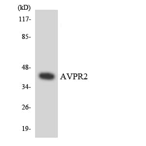 AVPR2 / V2R Antibody (aa62-111)