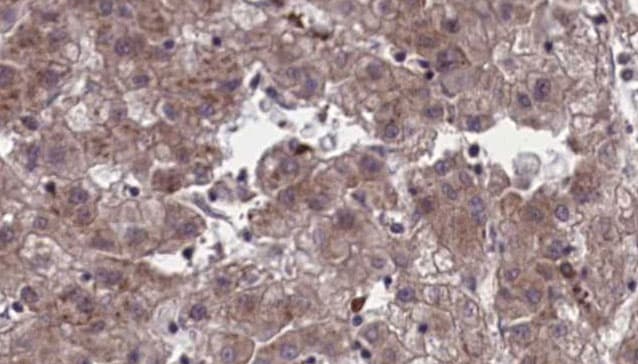 OR4C45 Antibody