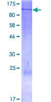 Human TEM1 / CD248 Protein (Recombinant GST)