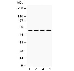 Polyclonal Rabbit anti-Human KRT18 / CK18 / Cytokeratin 18 Antibody (IHC, WB)