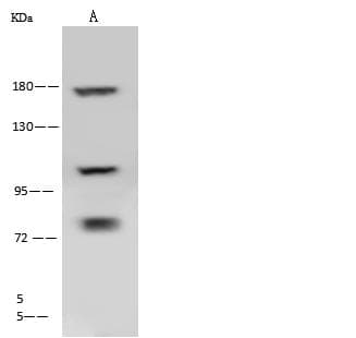 Polyclonal Rabbit anti-Human CLTC / Clathrin Heavy Chain Antibody (IHC, WB)