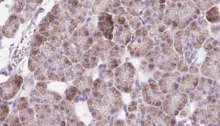 DIO1 / TXDI1 Antibody