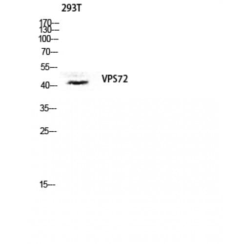 Polyclonal Rabbit anti-Human VPS72 Antibody (100-180 aa, Internal, IHC, IF, WB)