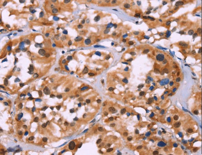 Polyclonal Rabbit anti-Human HIST1H1C Antibody (IHC)
