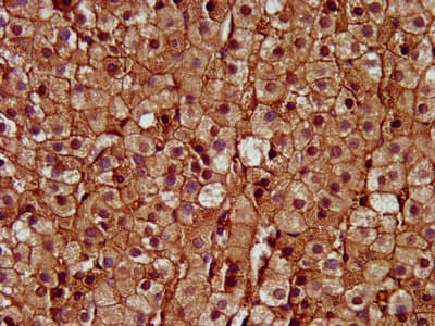 Polyclonal Rabbit anti-Human SAT2 Antibody (IHC, IF)