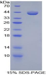 Guinea pig CCL5 / RANTES Protein (Recombinant His-GST)
