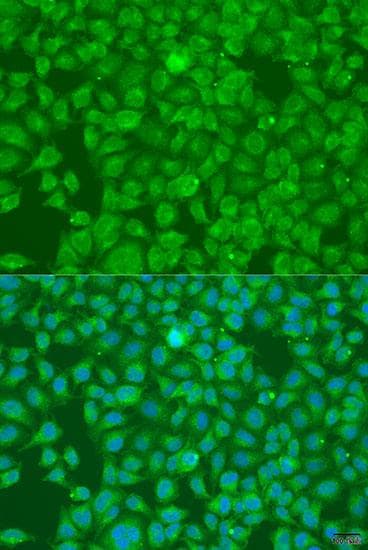 SLC25A6 / ANT3 Antibody