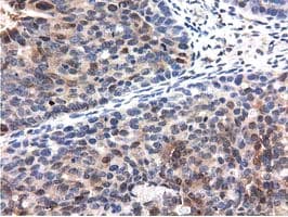 QPRT Antibody (clone OTI1C10, Carrier-free)