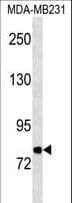 MFI2 / p97 Antibody (aa627-655)