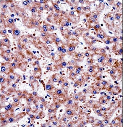 TAGLN2 / Transgelin 2 Antibody (aa136-165)