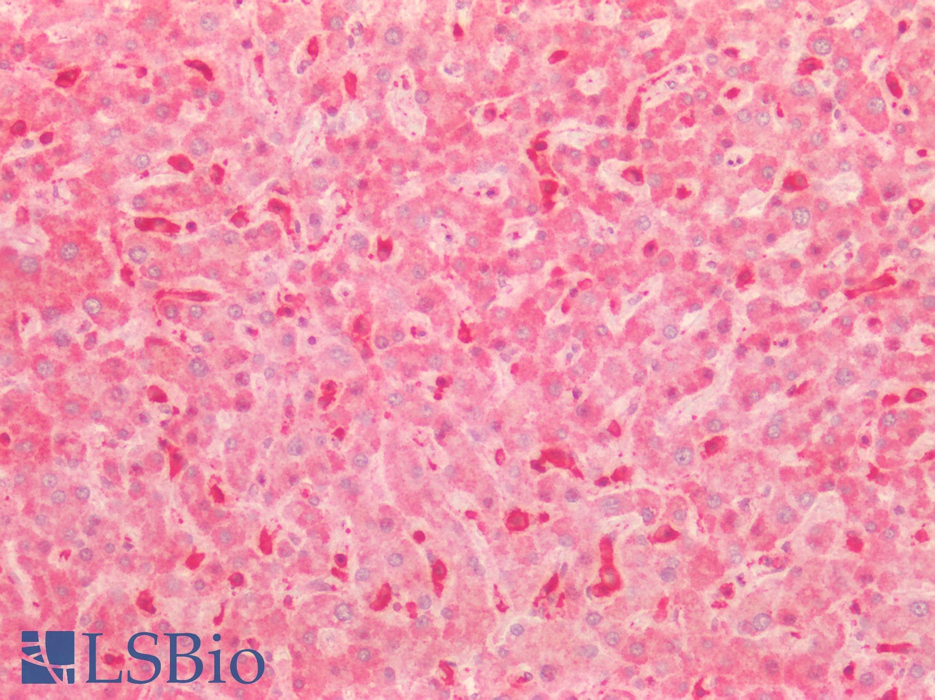 PathPlus™ KNG1 / Kininogen / Bradykinin Antibody (aa58-70)