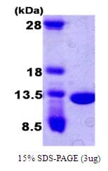 Human CKS2 Protein (Recombinant)