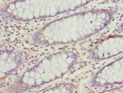 MCAD / ACADM Antibody