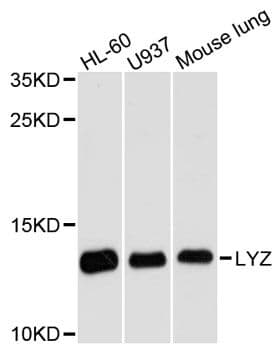 Polyclonal Rabbit anti-Human LYZ / Lysozyme Antibody (WB)