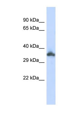 Polyclonal Rabbit anti-Human KRTAP24-1 Antibody (C-Terminus, WB)