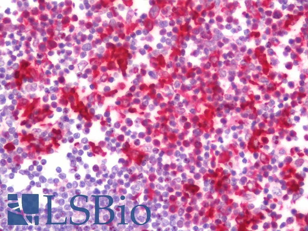 IHC-plus™ FZD5 / Frizzled 5 Antibody (aa31-80)