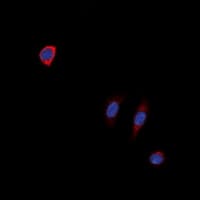 NTSR1 / NTR Antibody (Internal)