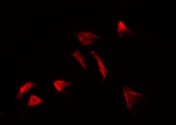 ADRB2 Antibody (phospho-Ser346)