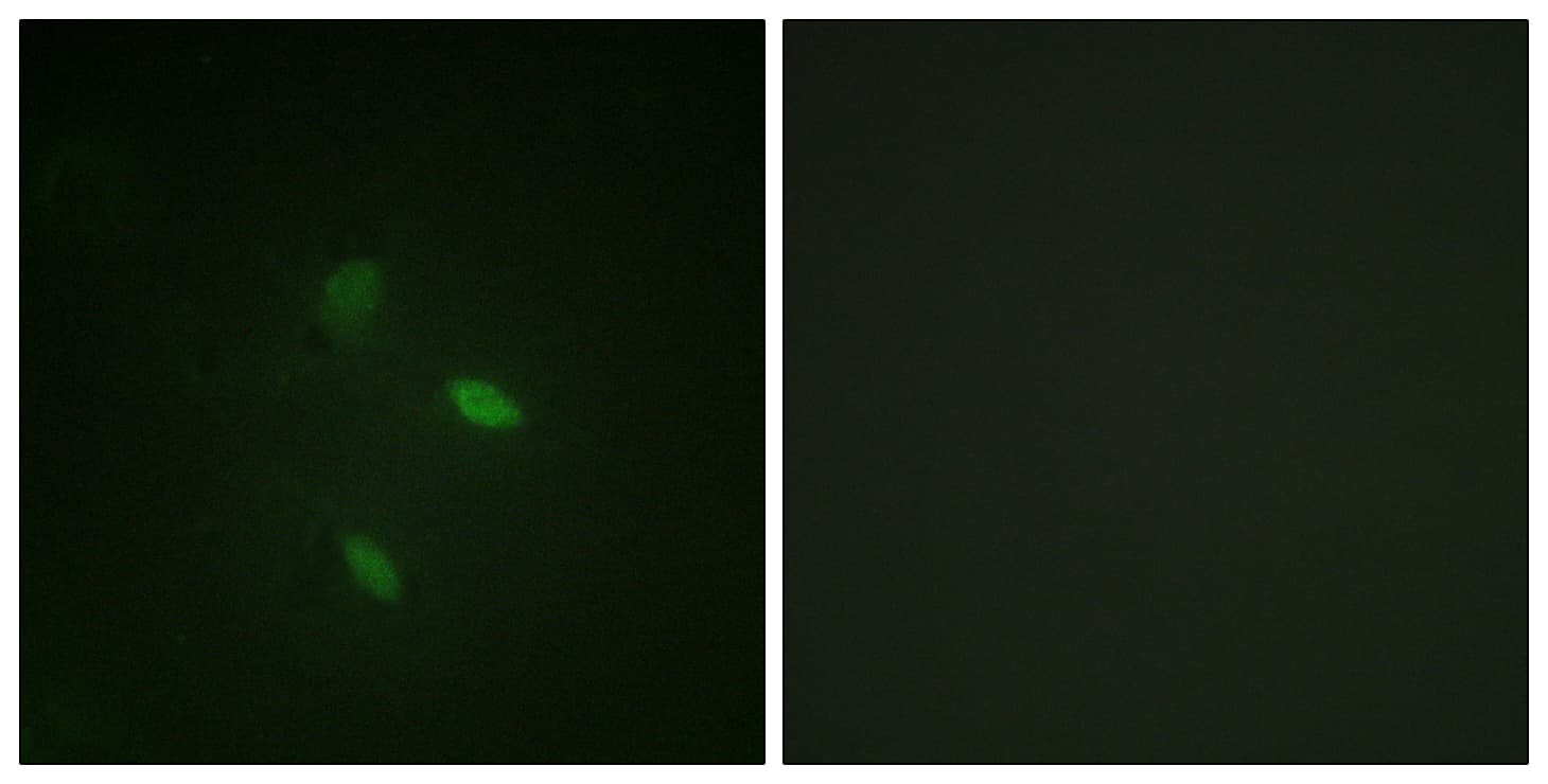 CCNE2 / Cyclin E2 Antibody (aa355-404)
