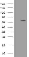 ESRRG / ERR Gamma Antibody (clone OTI1D10)